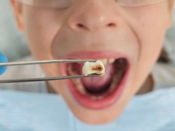 Best Urgent Dental Care  in Lawrencevle, IL
