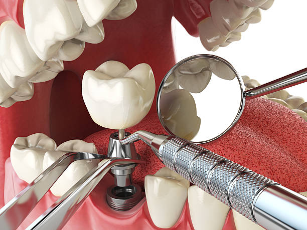 Best Tooth Pain Emergency Relief  in Lawrencevle, IL